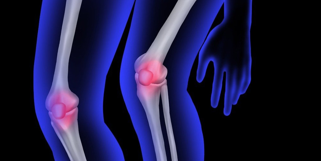 Zdj. ilustracyjne, źródło: pixabay.com